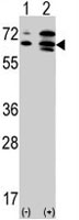 PAB2643 - Activin receptor type 2A / ACVR2A