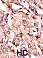 PAB2655 - BCKDK