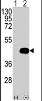 PAB2655 - BCKDK
