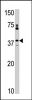 PAB2665 - CCRK / CDCH