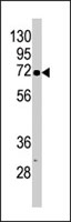 PAB2667 - CDKL2