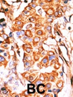 PAB2680 - Glycerol kinase 2