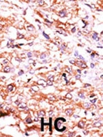 PAB2682 - GCS-alpha-2 / GUCY1A2