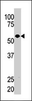 PAB2683 - Guanylate cyclase soluble GUCY1A3