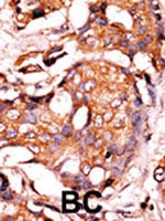 PAB2683 - Guanylate cyclase soluble GUCY1A3