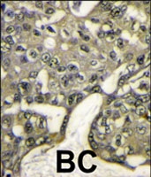 PAB2694 - AKT1 / PKB