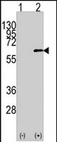 PAB2694 - AKT1 / PKB