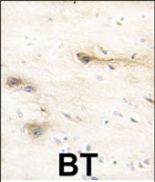 PAB2698 - MARK1