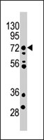 PAB2705 - MELK