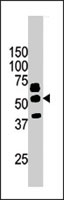 PAB2719 - PANK2