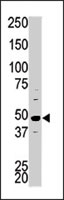 PAB2722 - CDK16 / PCTK1