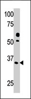 PAB2725 - Pyridoxal kinase / PDXK