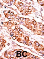 PAB2725 - Pyridoxal kinase / PDXK