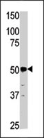 PAB2727 - Phosphoglycerate kinase 2 (PGK2)