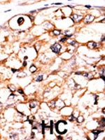 PAB2727 - Phosphoglycerate kinase 2 (PGK2)