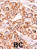 PAB2729 - PIP5K3