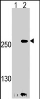 PAB2729 - PIP5K3
