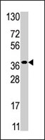 PAB2742 - Ribokinase / RBKS