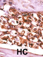 PAB2742 - Ribokinase / RBKS