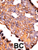 PAB2744 - Riboflavin kinase (RFK)