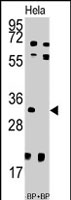 PAB2754 - UCK2