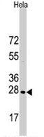 PAB2761 - HSPB1 / HSP27