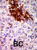PAB2762 - RIOK1