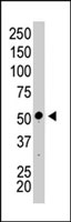 PAB2764 - PRKAA1