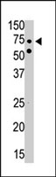 PAB2767 - PRKAA2