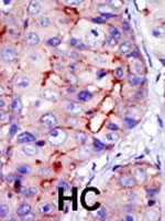 PAB2768 - CAMK1D