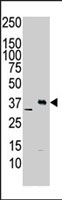 PAB2769 - CAMK1