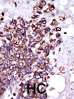 PAB2769 - CAMK1