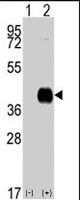 PAB2769 - CAMK1