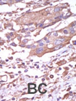 PAB2770 - CAMK2A