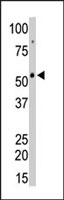 PAB2772 - CAMK2G / CAMKG