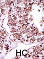 PAB2772 - CAMK2G / CAMKG