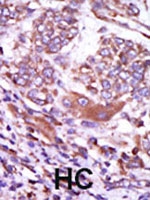 PAB2773 - CAMK2D