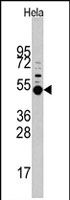 PAB2779 - MAPKAP Kinase-5