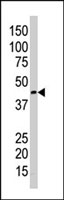 PAB2780 - DAPK2 / DRP-1
