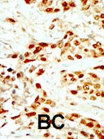 PAB2780 - DAPK2 / DRP-1