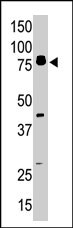 PAB2781 - Doublecortin-like kinase 1