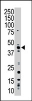PAB2784 - MAPK10