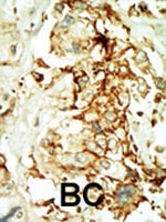 PAB2784 - MAPK10