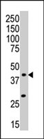 PAB2785 - MAP kinase p38 beta / MAPK11