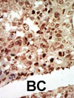 PAB2785 - MAP kinase p38 beta / MAPK11