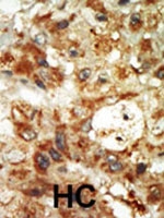 PAB2786 - MAPK12