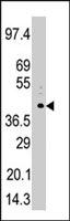PAB2794 - PHKG1 / PHKG