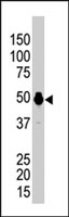 PAB2795 - PHKG2
