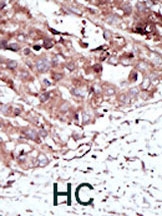 PAB2795 - PHKG2