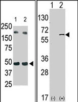 PAB2800 - Sphingosine kinase 1 (SPHK1)